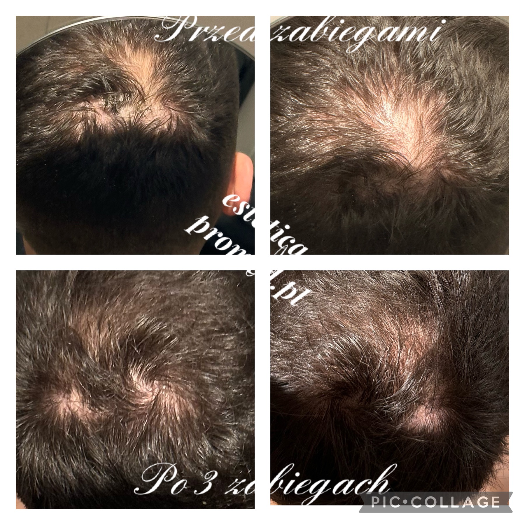 cyj włosy IMG 2973 3